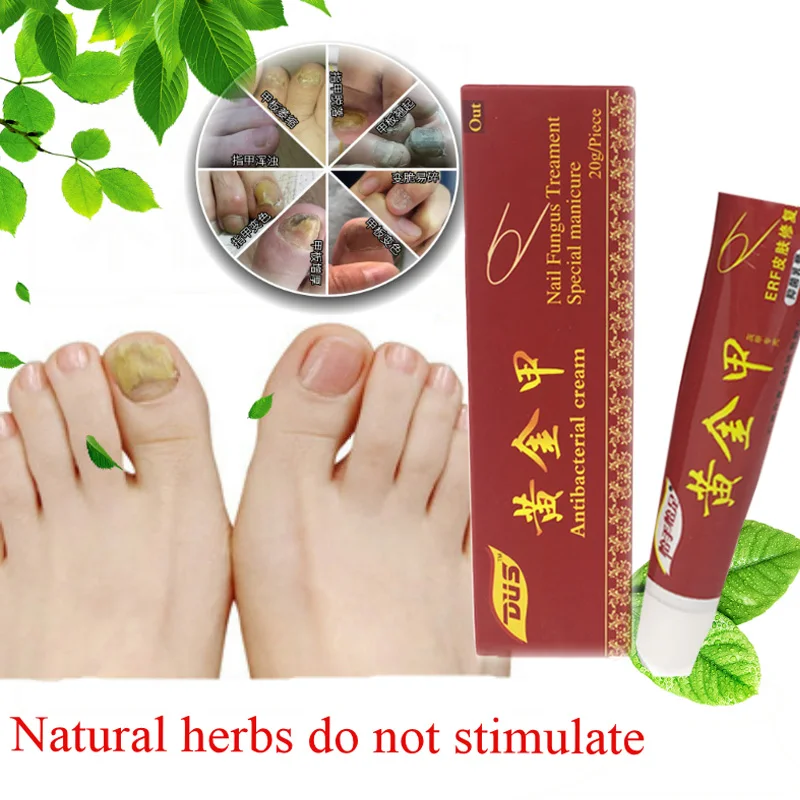 

2019 New Arrival Chinese Nail Fungus Treatment Ointment Treatment Toe Nail Onychomycosis Paronychia Anti Fungal Nail Infection