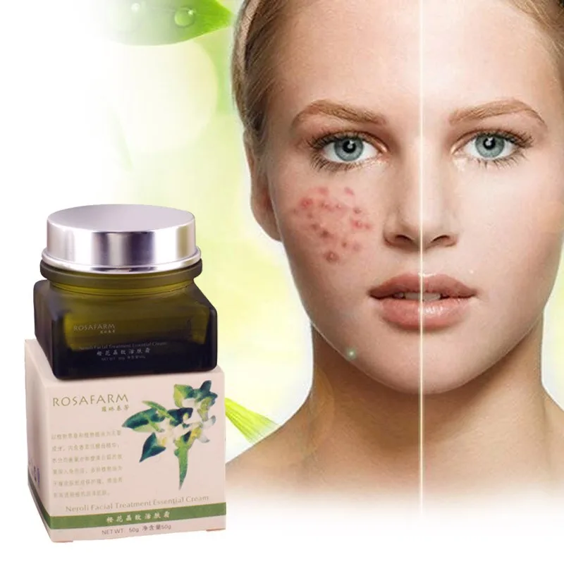 Уход за чувствительной кожей питает масло для кожи контроль акне натуральные растительные ингредиенты отбеливающий крем для лица