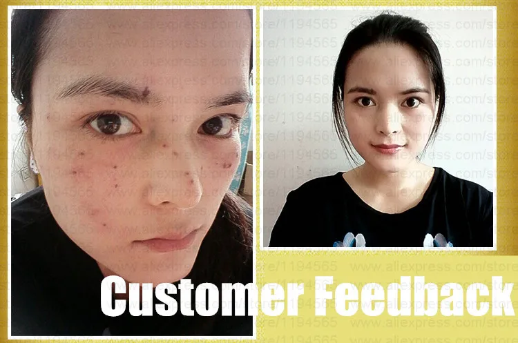 Оригинальные китайские лекарственные средства для удаления веснушек морщин и