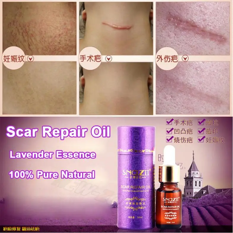 Buy 3*10ML Good Effect Remove Scar Repair Essential
