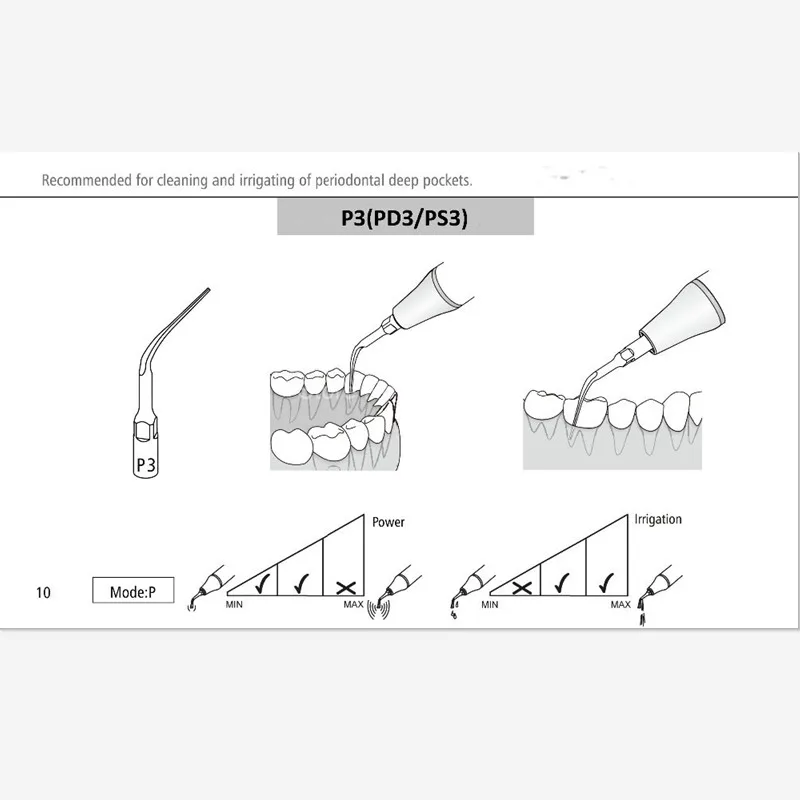 Koop 5 Pcs PD3 Dental Scaler Tips Tandheelkundige Apparatuur Tanden Whitening Ultrasone Tandheelkundige Scaler Tip PD3 Voor Satelec Nsk Gnatus Dte