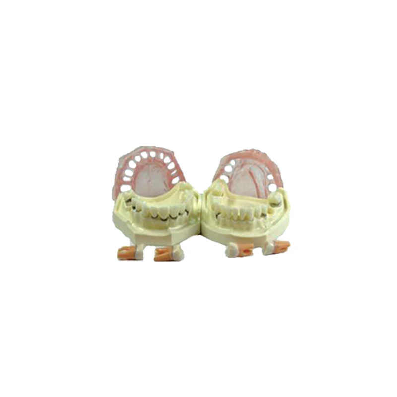 

Dental Implant Disease Teeth Model Peridontal Disease Model