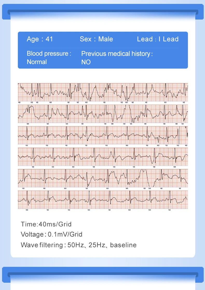 ECG + PPG водонепроницаемые Смарт-часы, кровяное давление, пульсометр, браслет для здоровья, погода, показ калорий, смарт-браслет PK mi band4