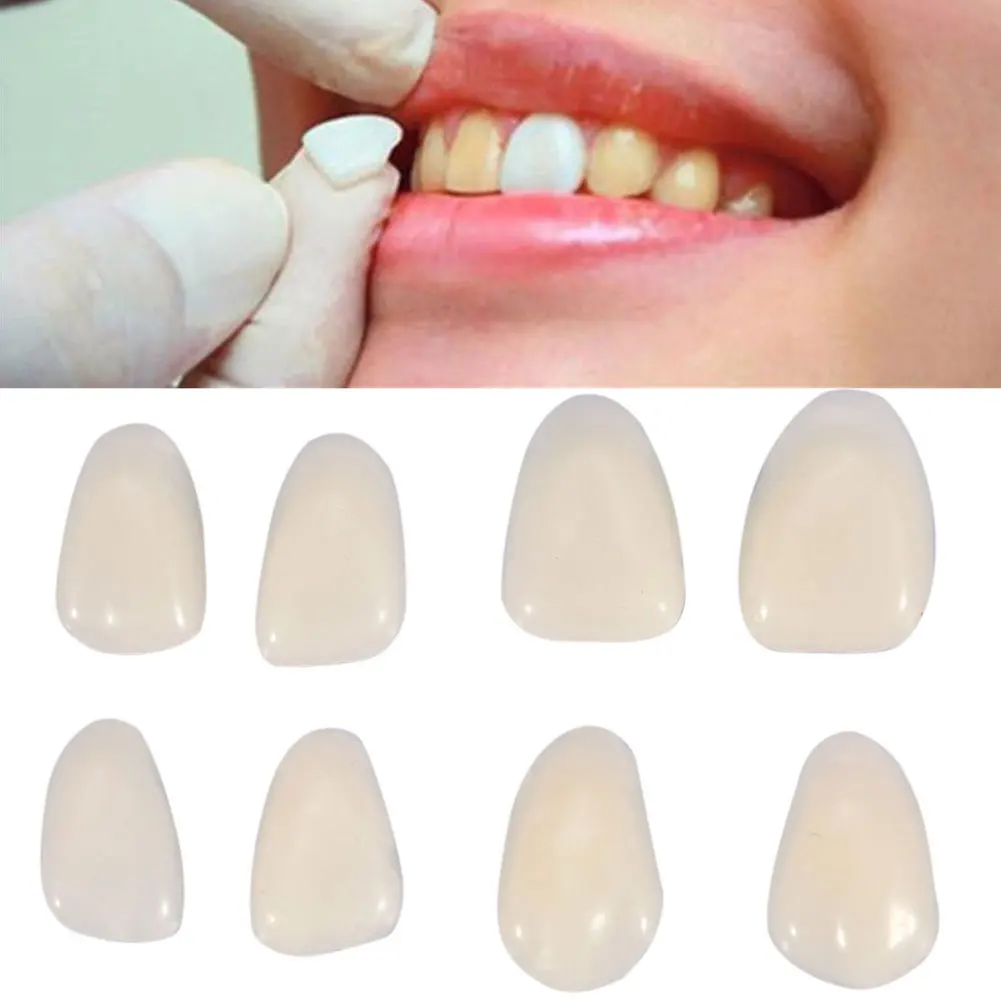 Новинка 1 упаковка стоматологических материалов ультратонкие композитные полимерные виниры верхних передних зубов стоматолога восстановительное отбеливание зубов