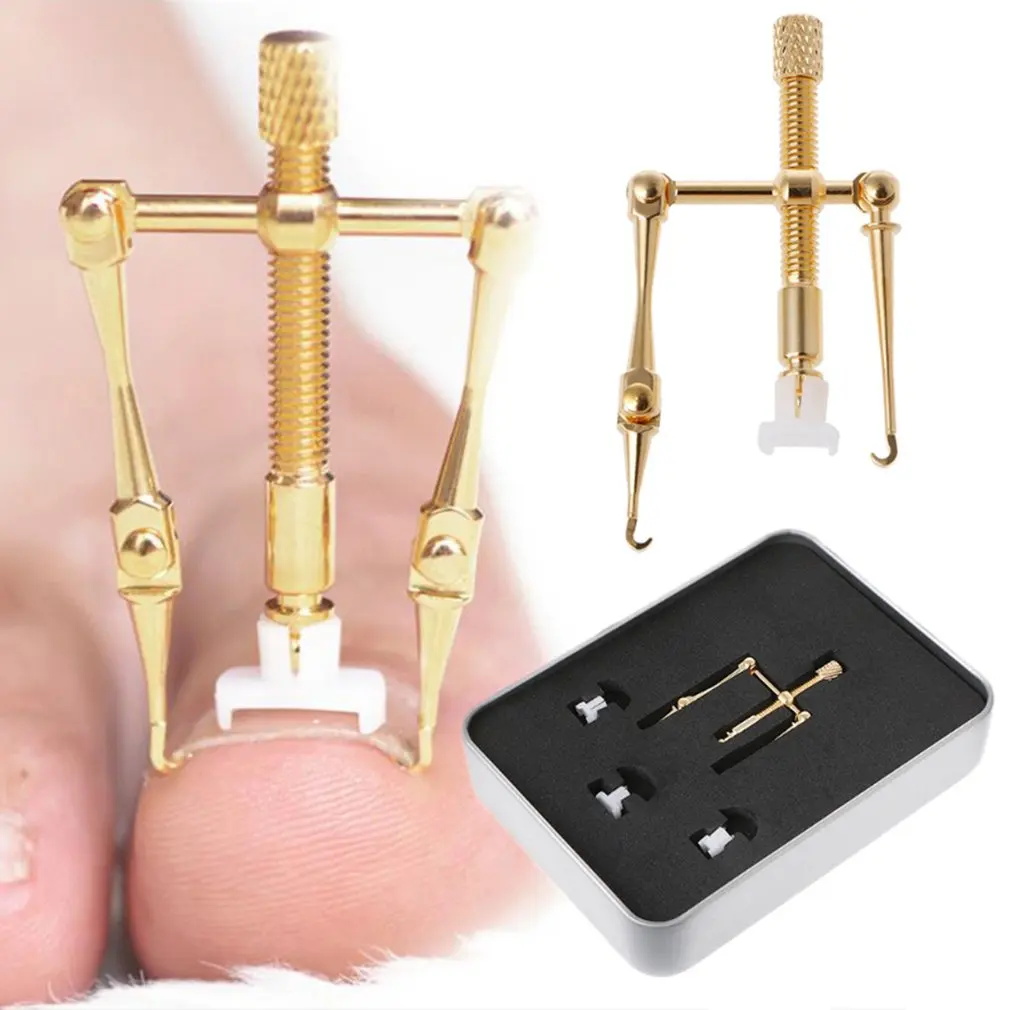 Корректор для ногтей вросшего ногтя инструмент для коррекции ног инструмент для лечения вросшего ногтя восстановление носочной паранихии ногтей скобы для ступней уход