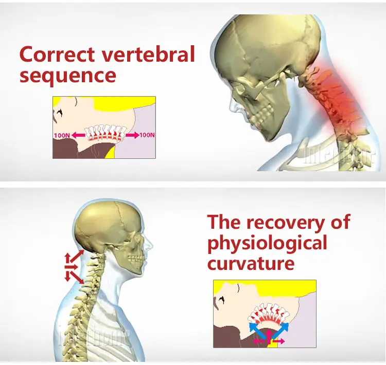 Cervical-spine-Brace(7)