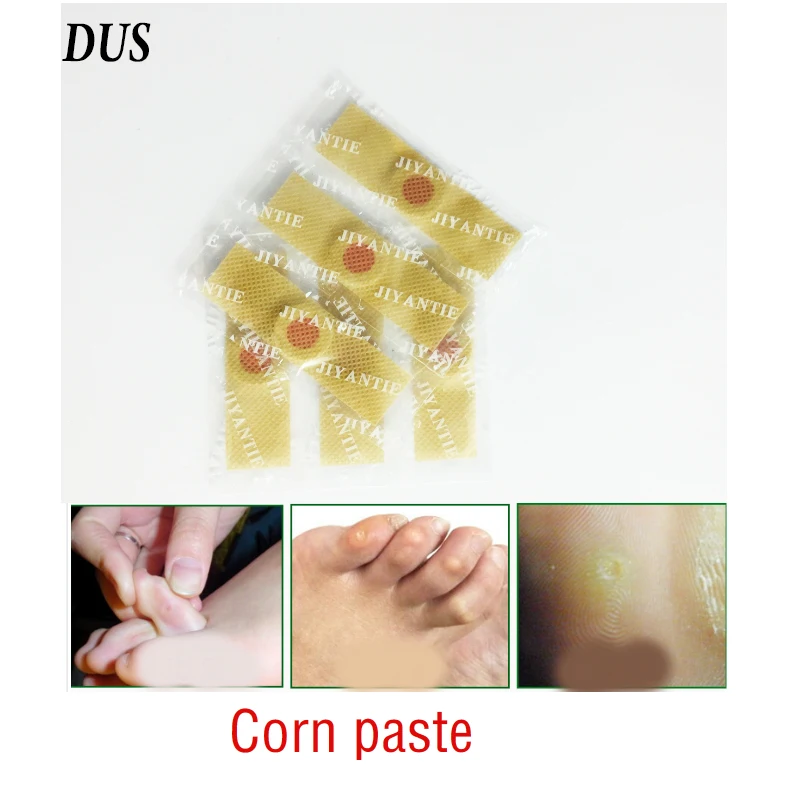 DUS 20 قطعة القدم الرعاية الطبية الجص القدم الذرة إزالة النسيج الجص الثآليل شوكة الجص الرعاية الصحية لتخفيف الألم