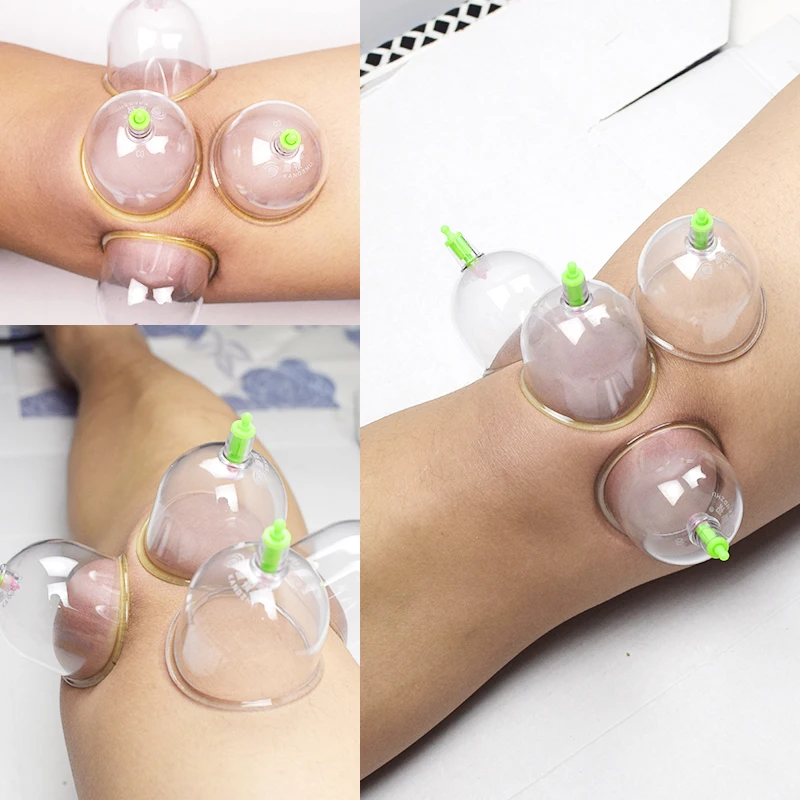 joint-cans-vacuum-cupping-device-large-knee-shoulder-joint-massage-cup-4-9cm-diameter-5pcs