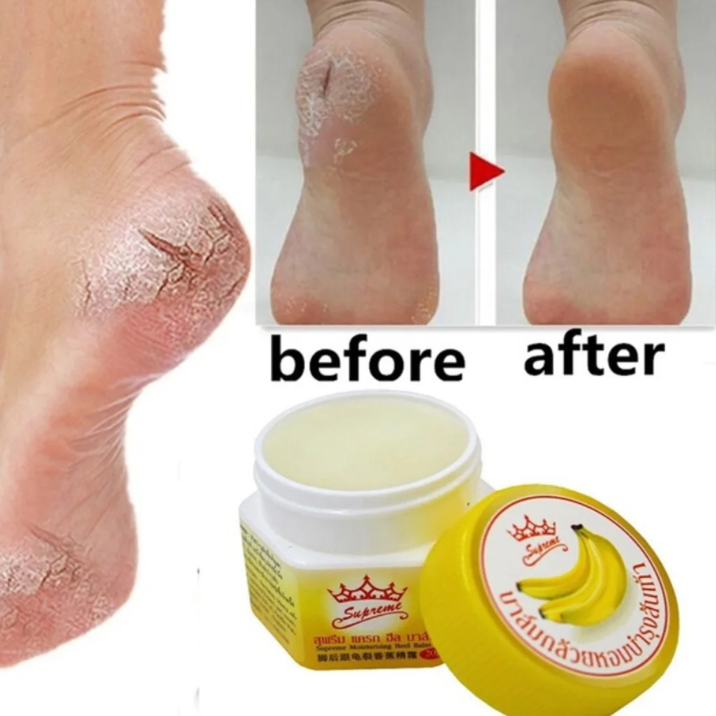 

Foot Care Foot Banana Oil Repair Scruber Dead Skin Remover Anti Chapped Anti-Drying Crack Cream Healthy Foot Care Tool Dropship