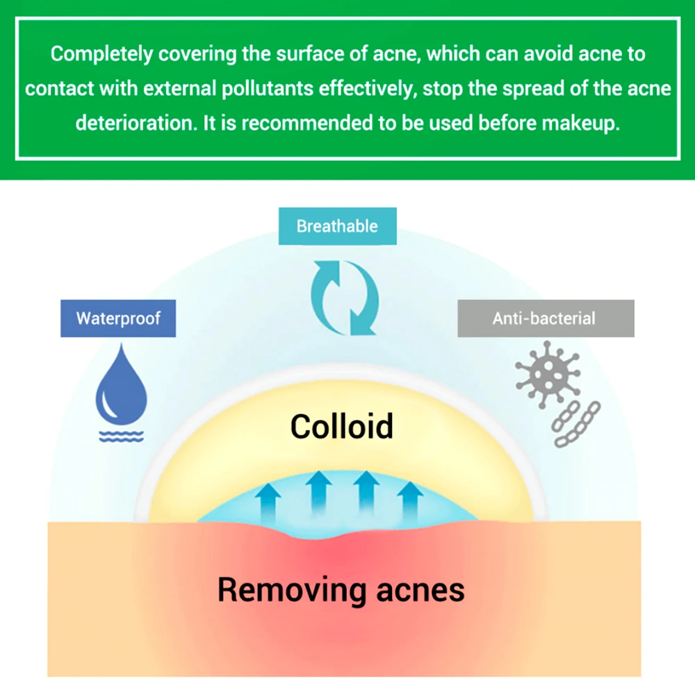 Невидимый пластырь для удаления прыщей может эффективно поглощать секреции Акне Патчи для быстрого заживления подходит для ночного времени