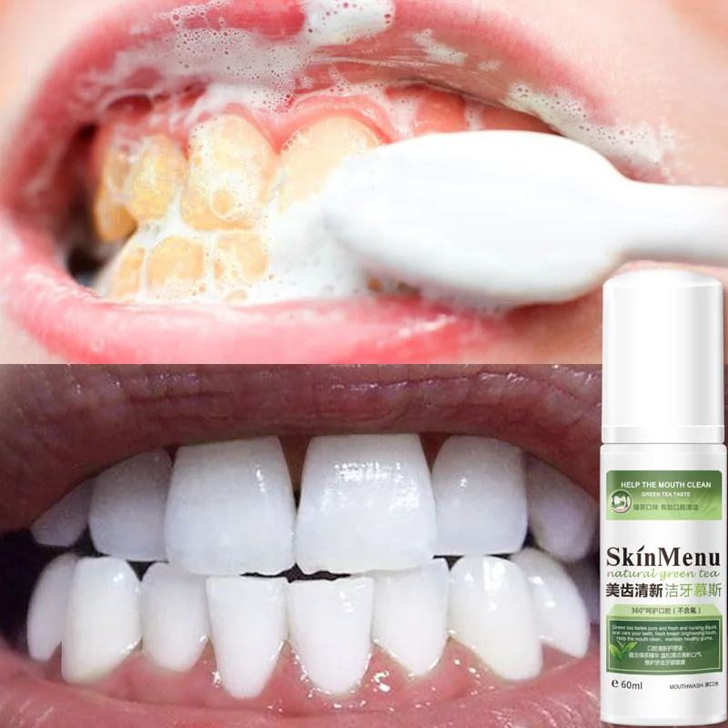 

Teeth Whitening Essence Green Tea Oral Hygiene Cleaning Serum Removes Plaque Stain Tooth Bleaching Dental Tools Toothpaste TSLM1