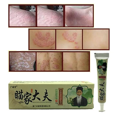 Zudaifu псориаз крем от псориаза мазь YIGANERJING дерматит Eczematoid Eczema мазь лечение кожи крем - Цвет: Прозрачный