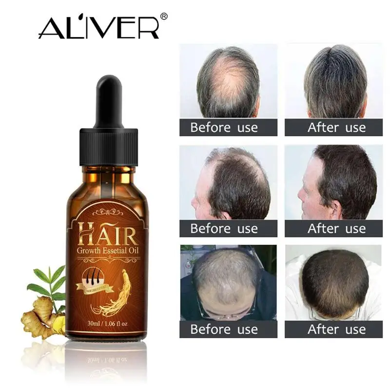 New Fast Powerful Hair Growth Essential Oil Regrowth Essence Liquid Treatment Preventing Hair Loss Hair Care 30ml