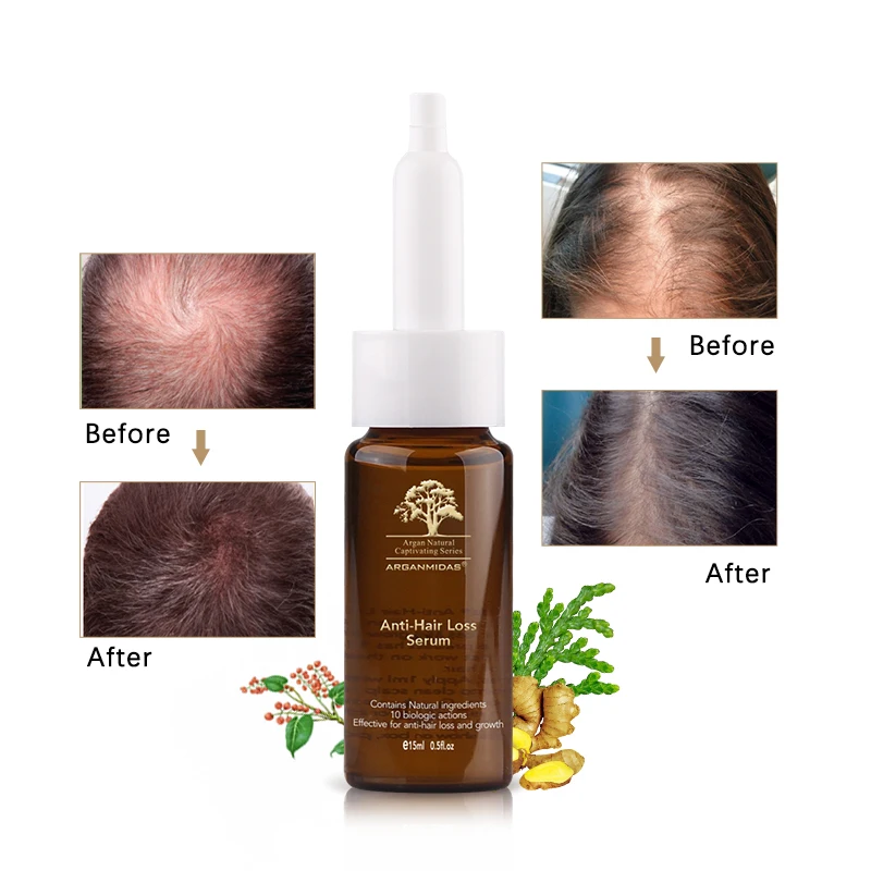 15 мл против выпадения волос масло имбиря продукт для роста волос натуральный экстракционный материал для мужчин и женщин