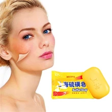 Горячая Шанхай серное мыло забота о здоровье анти бактерии от акне, псориаза Себорея клещей проблемное лечение кожи