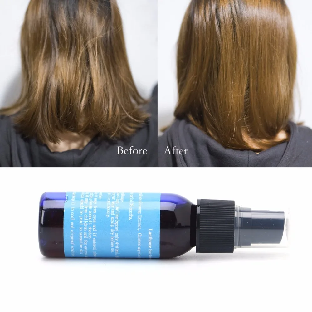30ml 1PC Hair Growth Liquid Spray Alopecia Pilatory Anti Hair Loss of Hair Regrowth