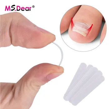 

10pcs/box Ingrown Toe Nail Correction Sticker Patch Paronychia Correction File Acronyx Wire Corrector Foot Care Tool Health Care
