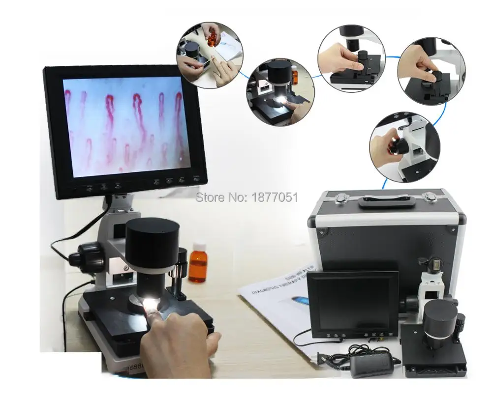 

2019 suyzeko Capillaroscope Detection Instrument Microcirculation Microscope with CE