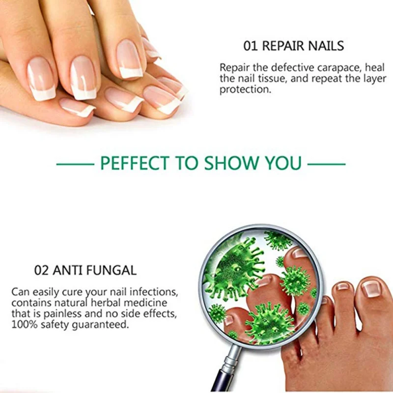 Rtopr ginger antibacterial nail essential oil. средство от грибков ногтей. лечение ногтей волжский фуст. какое масло от грибка ногтей. масло для ногтей ног лечебное.