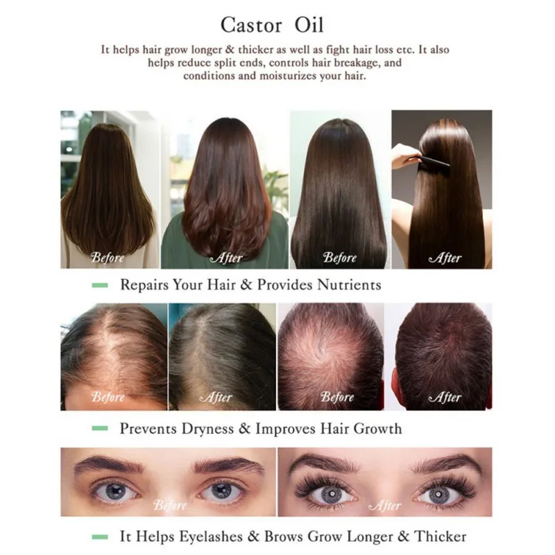 Black Castor Oil For Natural Hair Growth Essential Oil Castor