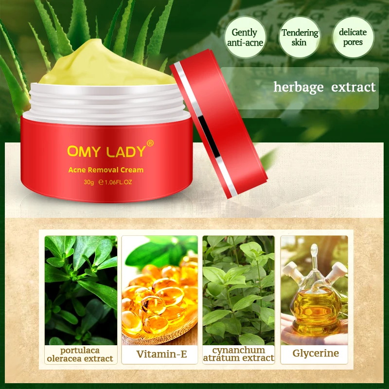 OMY LADY Strentch Marks акне крем для удаления шрамов лечение усадка пор гель отбеливания