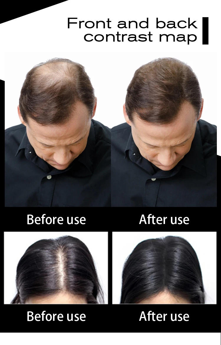 50 г Sevich волосы волокна строительного волокна волос кератин более толстые продукты для лечения выпадения волос порошок для укладки Regrow 10 цветов