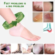 2 шт силиконовый пяточный рукав для восстановления травм пятки снимает давление пятки и защищает пятки стельки по уходу за ногами