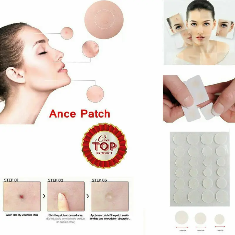 

48/72PC Skin Tag Acne Patch NEW Hydrocolloid Acne and Skin Tag Remover Patches
