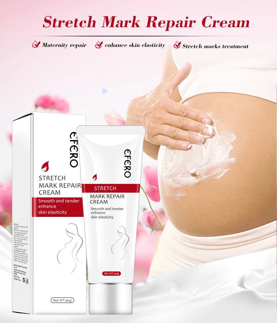 Крем для удаления рубцов от акне растяжек крем для удаления жирных шрамов Гладкий крем для кожи лечение растяжек для женщин крем для беременных EFERO