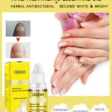 10 мл Лечение грибка ногтей и стойкая противогрибковая удаление онихомикоза Уход за ногтями ремонт раствор продукты для ногтей