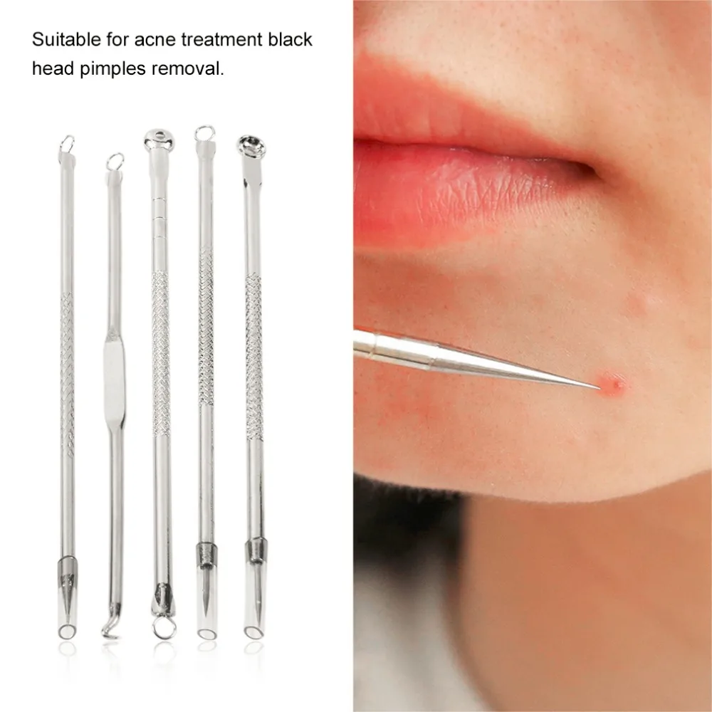 Big Sale 5pcs/set Stainless Steel Acne Needles Pimple Remover Skin