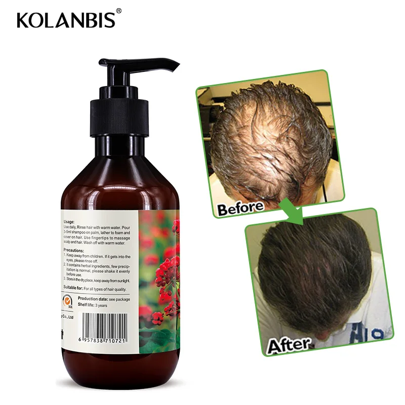 Шампунь для волос травяные натуральные продукты для роста волос загуститель против выпадения волос для всех типов волос