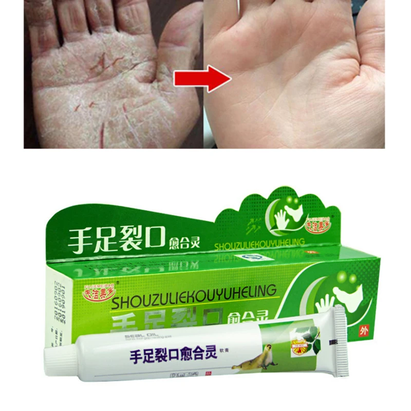 

Powerful Chinese Ointment Cream Hand Foot Crack Cream Chapped Peeling Foot and hand Repair Anti Dry Crack skin care