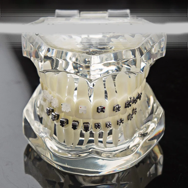 

Dental Orthodontic Model Self-ligating Bracket Straight Wire Edgewise Bracket Four Kinds Ceramic Brackets Comparison Model