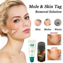 

Mole Skin Tag Removal Solution Painless Mole Skin Dark Spot Removal 1pc Face Wart Tag Freckle Removal and 2pcs Repair Cream