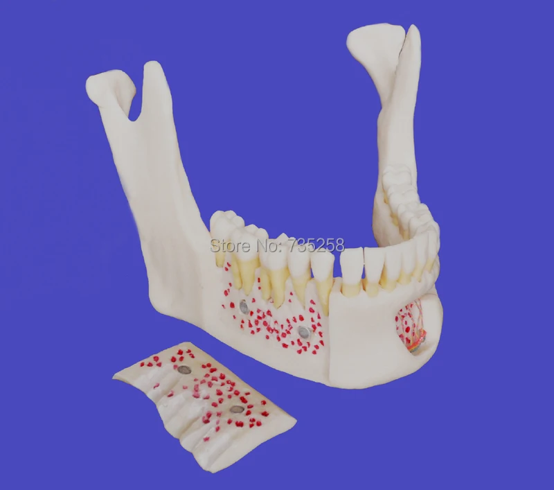 Senior 1:1 имитационная модель Mandible, высокая копия neurovascusic mandibulal Teeth модель