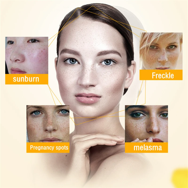 Chumolee Pure 99 Kojic Acid Powder Whitening Face Cream Remove Freckle Melasma Acne Scars Pigment Melanin Dark Sopts Face Care Facial Self Tanners Bronzers Aliexpress