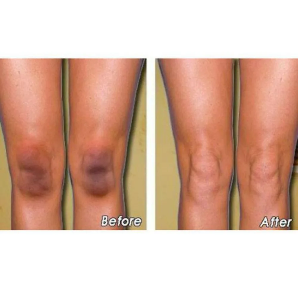 

Ultra Brightening Spotless Oil Remove Dark Spots Age Spots Hyper-Pigmentation Slimming Essential Oil