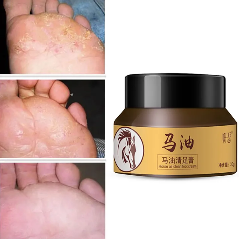 Horse Oil Feet Cream Soothing Repair Feet Care Itch Blisters Anti