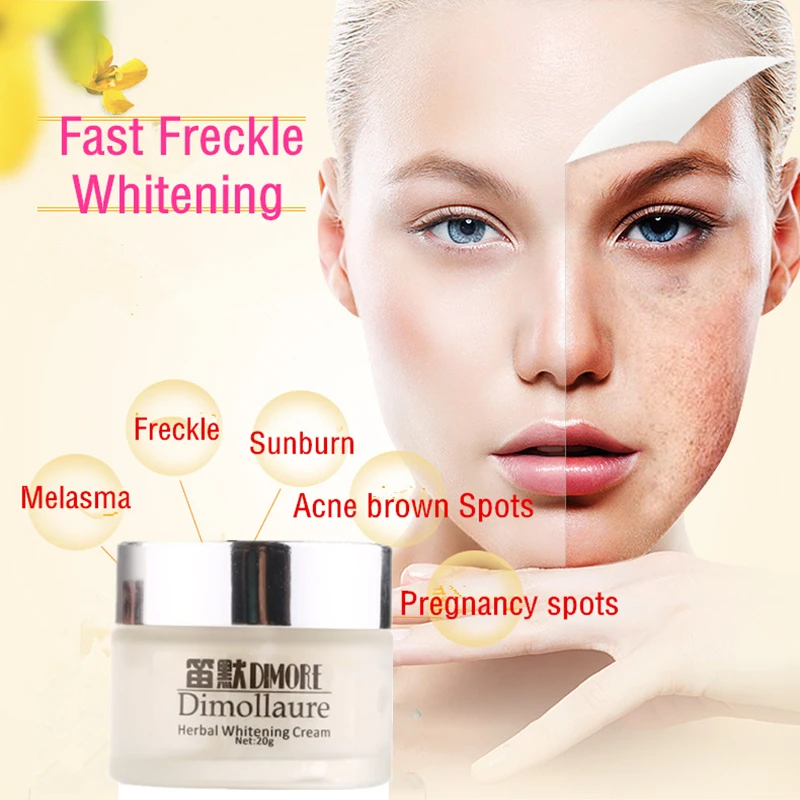 Dimollaure Retinol Vitamin A herbal whitening Freckle cream removal melasma Acne Spot pigment Melanin Dimore scar removal cream