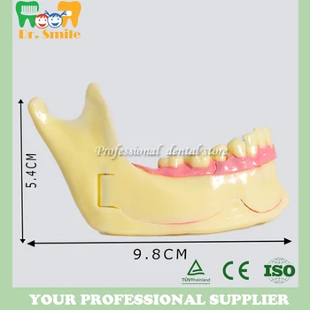 

Dental Lower Mandibular Tissue Teeth Model Dentist Demonstration Anatomical For Medical Patient Study Teaching Model