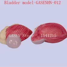 Модель увеличения простаты мочевого пузыря урогенитальная система медицинский учебный аппарат model-GASENHN-012 мочевого пузыря