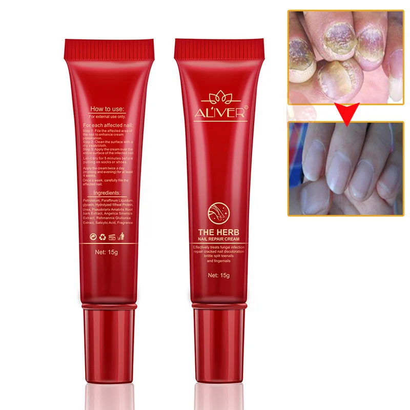 

Aliver The Herb Nail Repair Cream Nail Treatment Nail Anti Fungus Removal Soft Care Foot Long-term Protection