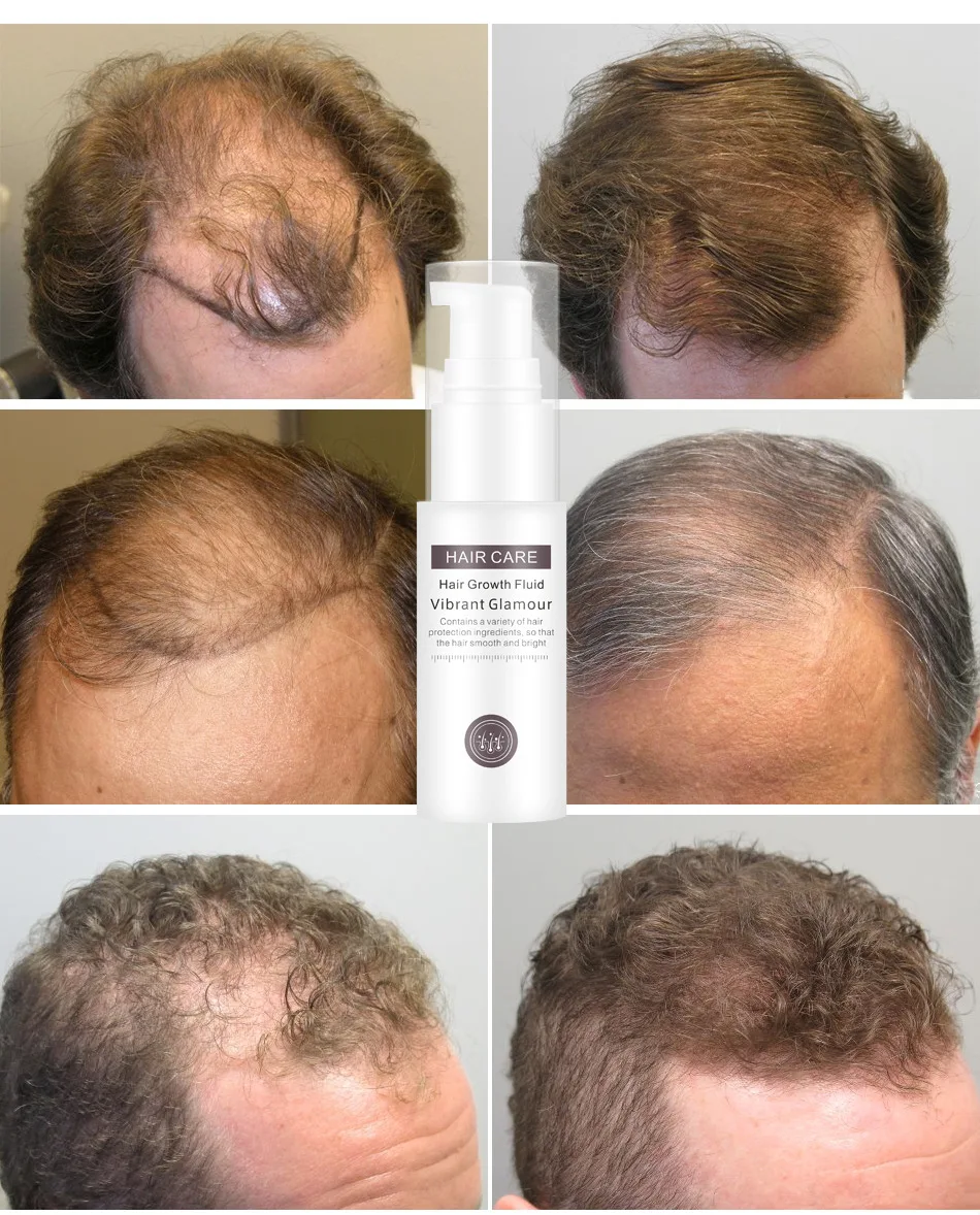 Эффективный жидкий спрей для роста волос против выпадения волос для восстановления сухих волос Увлажняющая сыворотка Уход за волосами