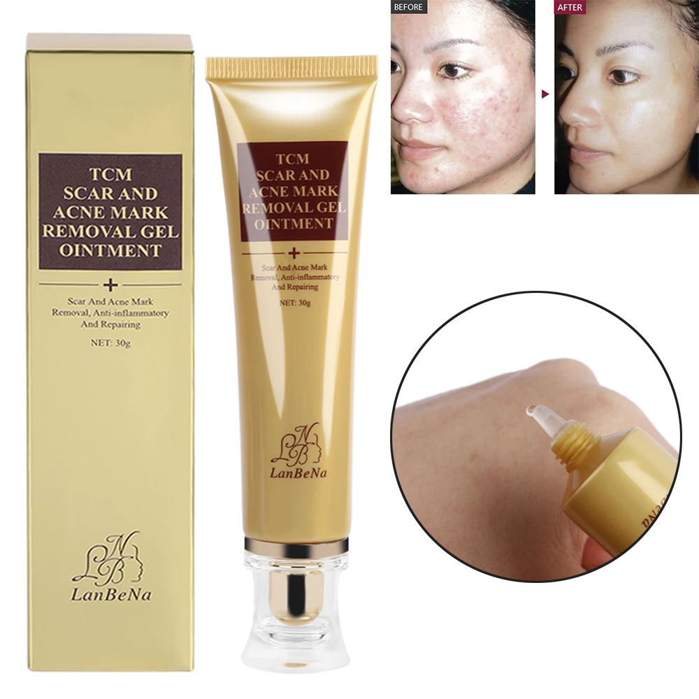Aliexpress.com : Buy Ginseng extract against black dots