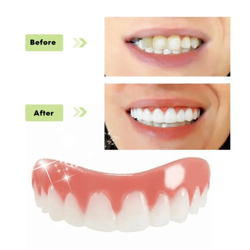 Professional teeth whitening veneers Perfect smile veneers teeth Natural teeth whitening smile
