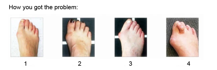 2Pcs 2 Hole Feet Foot Care Gel Toe Straighteners Separator Hallux Valgus Bunion Corrector Pain Relief Foot Massager C136 2Pcs 2 Hole Feet Foot Care Gel Toe Straighteners Separator Hallux Valgus Bunion Corrector Pain Relief Foot Massager C136