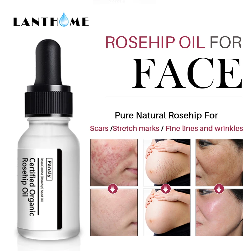 spesifikasi Murni Organik Rosehip Minyak Whitening Pelembab Anti Aging Rose Hip Oil Minyak Perawatan Kulit Acne Scar Serum Stretch Mark remover