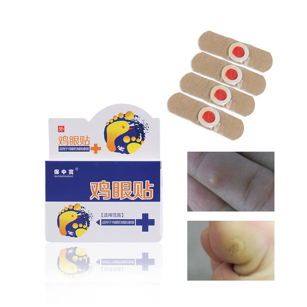 6 Pcs Foot Corn Remover Calluses Plantar Warts Anti germ Thorn Pain Relief Plaster Foot Care