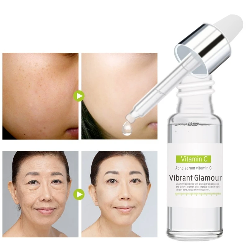 Vitamin C VC Original Liquid Whitening Serum Skin Care Acne Treatment